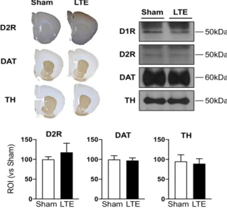 Fig.  3.  Neuro-PET  imaging  for  dopamine  receptor(D2R).