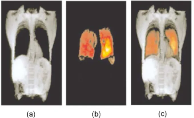 Fig. 1. (Color online) First human lung image ac- ac-quired with hyperpolarized xenon: (a) Proton MRI  im-ages showing no signal over the lung space, (b) Polarized