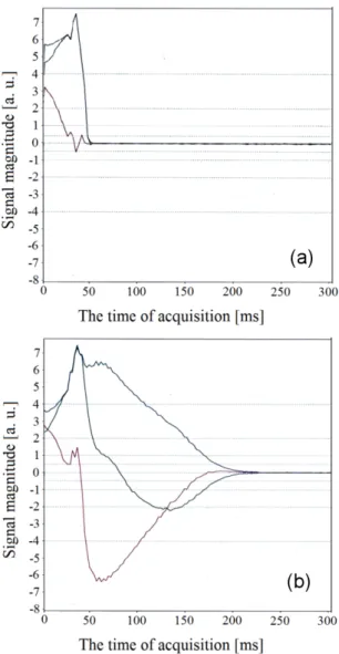 Fig. 8. (Color online) Comparison between background and water NMR signal in the frequency domain: a) the background, b) the background plus water NMR signal.