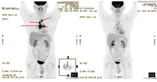Fig.  2.  Change  of  PET/CT