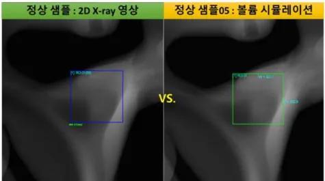 그림  24 무결함  X-ray  시뮬레이션  영상(우)과  정상  샘플  영상(좌)의  유사도  비교 :  NCC  패턴  매칭  유사도  =  0.99 - 결함이  없는  정상  샘플의  경우,  무결함  시뮬레이션  영상과의  NCC  유사도  비교  결과  0.99의  높은  유사도를  보인  반면,  크랙  형상의  결함  존재  부위에  대해서는  0.83의  낮은  유사도를  보임