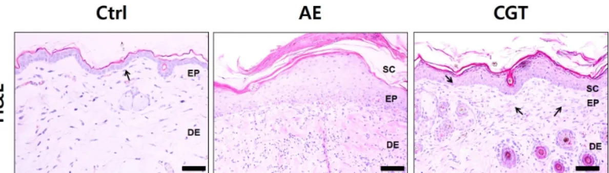 Fig.  2.  Alleviating  effect  on  symptoms  of  AD. 