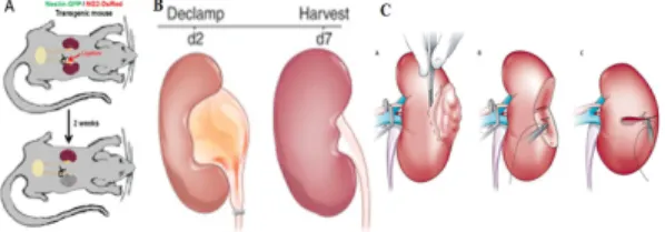 Fig.  1.  radical  nephrectomy  and  UUO  establishment