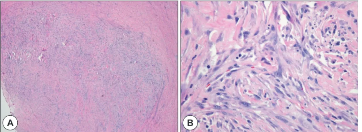 Fig. 2. Microscopic findings of low power field demonstrates hyercellularity (A: H&amp;E stain, ×40)