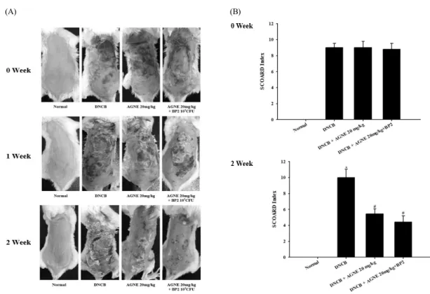 Fig. 3. The effect of AGNE and AGNE+BP2 on the DNCB-induced atopic dermatitis. The BALB/c mice (n=6) were sensitized  with 150 μL of 0.5% DNCB in acetone–olive oil(3:1) or vehicle applied to the dorsal skin twice each week for a total  period of 3 weeks