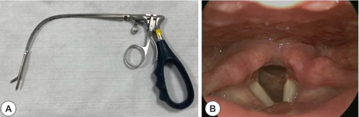 Fig. 2. A : Curved long forceps used to remove parasites. B : Laryngoscopic finding after removal of parasite.