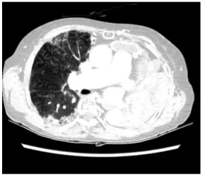 Fig. 1. Chest CT image.