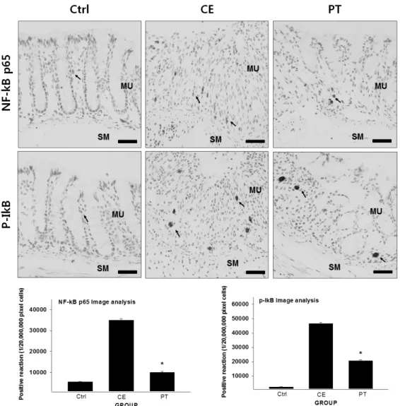 Fig. 4. The inhibitory effect of PE on NF-κB p65 and p-IκB in the colon mucosa. Abbreviations: Ctrl, the mice which  was not treated anything; CE, the mice which was treated DSS only; PT, the mice which was treated both DSS  and PE; MU, colonic mucosa; SM,