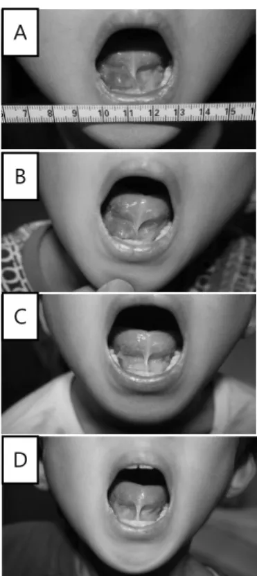 Fig. 1. Photographs of Clinical Changes of Case 1.