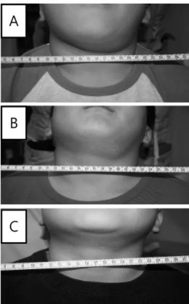 Fig. 3. Photographs of Clinical Changes of Case 3.