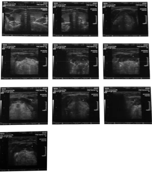 Fig. 4. Ultrasonography of Case 3 on 2016-03-09.  