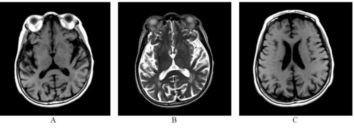Fig. 1. Brain MRI