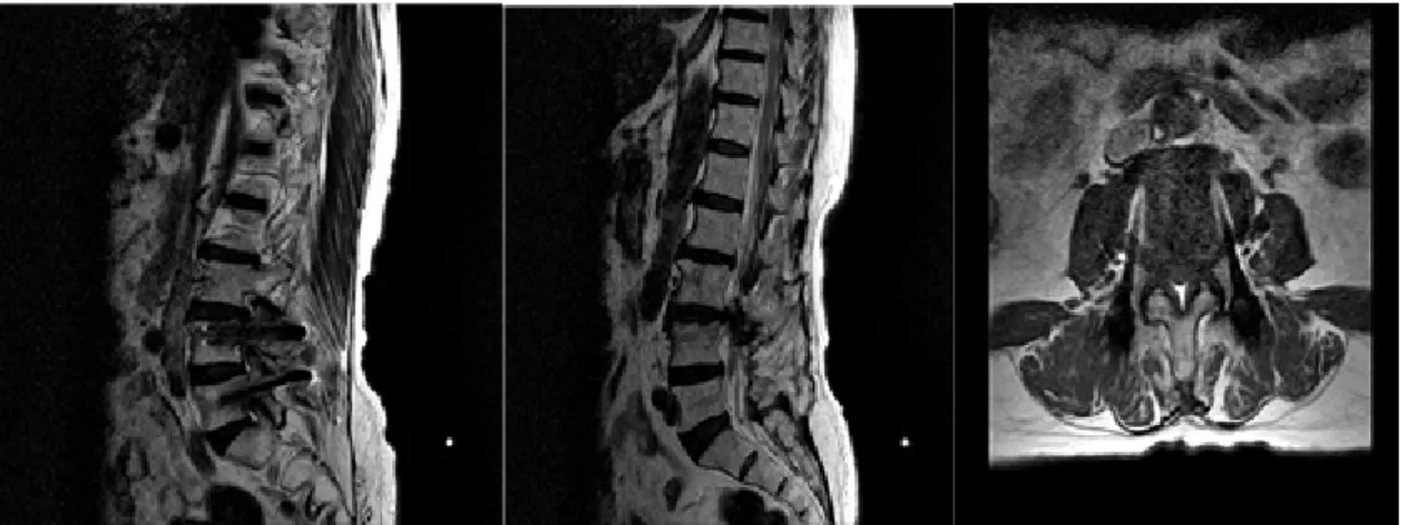 Fig. 1. 2014/05/20, Sagittal image, L3-L4 axial image