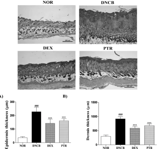 Fig. 2. Effects of PTR on skin thickness in DNCB-induced mice. (A) The thickness of epidermis, (B) the thickness of dermis