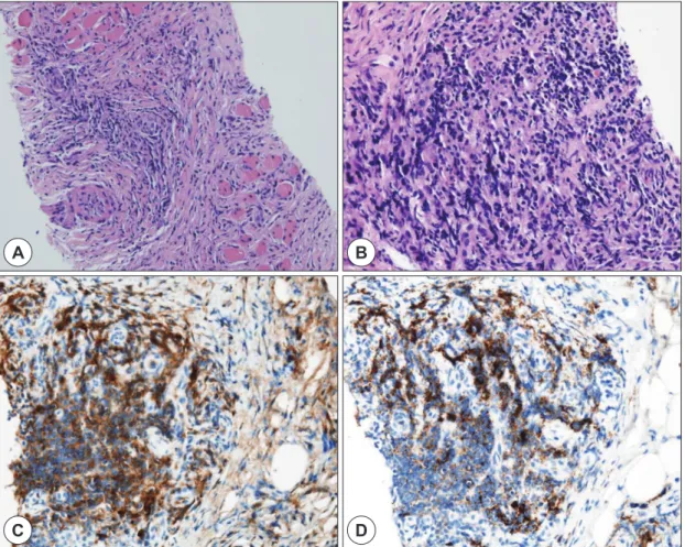Fig. 2. Histopathologic findings obtained by ultrasonography-guided core needle biopsy