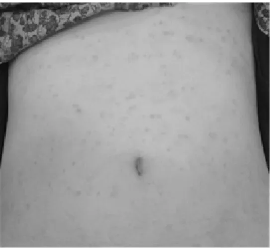 Fig. 1. Before treatment (2011-05-27)  Fig. 2. After 86 days of treatment (2011-07-30)