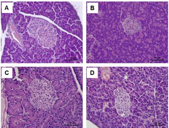 Fig. 4. Histological examination of β-islet in rat pancreas. (A) normal rats, (B) diabetic rats treated with vehicle, (C)  diabetic rats treated with metformin, (D) diabetic rats treated with AJ