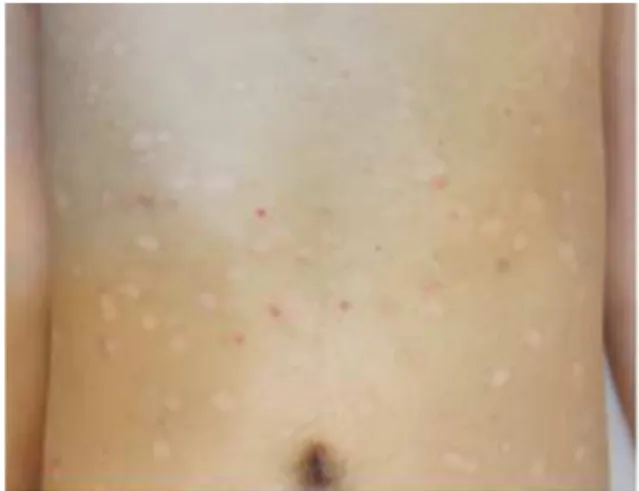 Fig. 2. after 18 days (2013-11-29)