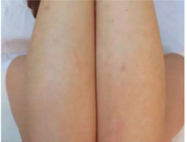 Fig. 6. after treatment (2014-02-15)