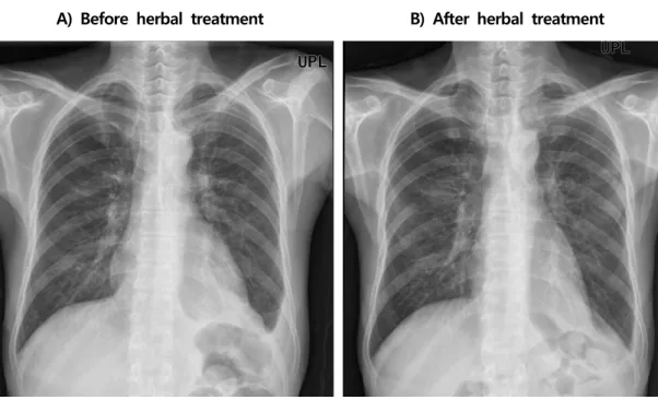 Fig.  3.  The  change  of  radiographic  images.