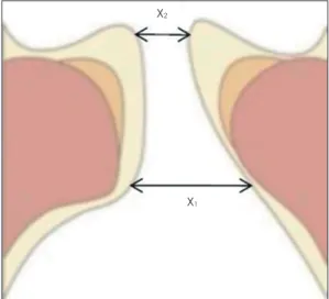 Table 2. Possible causes of the failure of physiological vocal fold movement to recover after injury