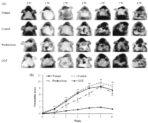 Fig.  3.  Clinical  Features  (A)  and  Dermatitis  Scores  (B)  of  the  Back  and  Ears  of  NC/Nga  Mice