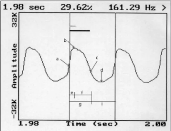 Fig. 3. Electroglottogram. a : closure of lower lip of true  vocal fold, b : full adduction of true vocal fold, c :  open-ing of lower lip of true vocal fold, d : full abduction of  true vocal fold, e : closing phase, f : opening phase, g :  closed phase, 