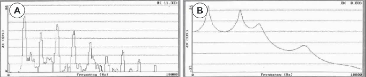 Fig. 4. Spectum. A: Fast fourier transform (FFT). B: Linear predictive coding (LPC).