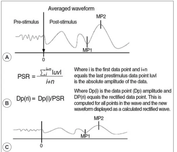 Fig. 1. Schematic flowchart of prestimulus rectification (PSR) function. A : System obtains averaged waveform and  user marks points (MP) on it