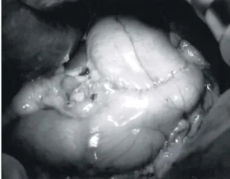 Fig.  1.  Operative  photograph  of  completed  reconstruction.
