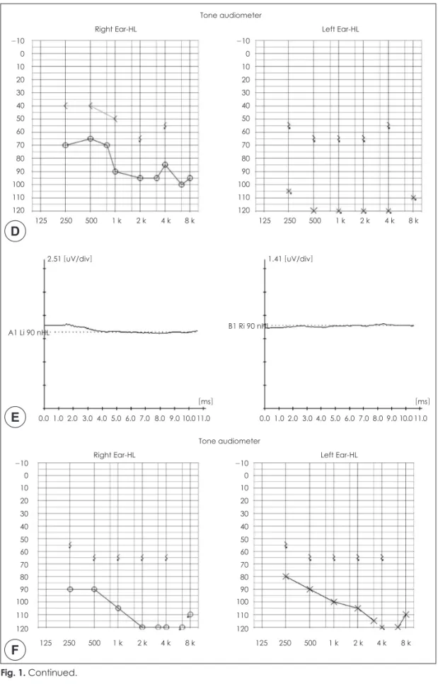 Fig. 1. Continued. 0.0  1.0  2.0  3.0  4.0  5.0  6.0  7.0  8.0  9.0  10.0 11.0 0.0  1.0  2.0  3.0  4.0  5.0  6.0  7.0  8.0  9.0  10.0 11.0125     250      500      1 k       2 k      4 k       8 k125     250      500      1 k       2 k      4 k       8 k2.