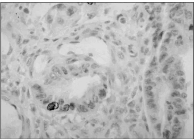 Fig.  1.  Immunohistochemical  staining  for  p16 INK4A   is  diffusely  expressed  in  the  normal  colonic  epithelium  (×400).