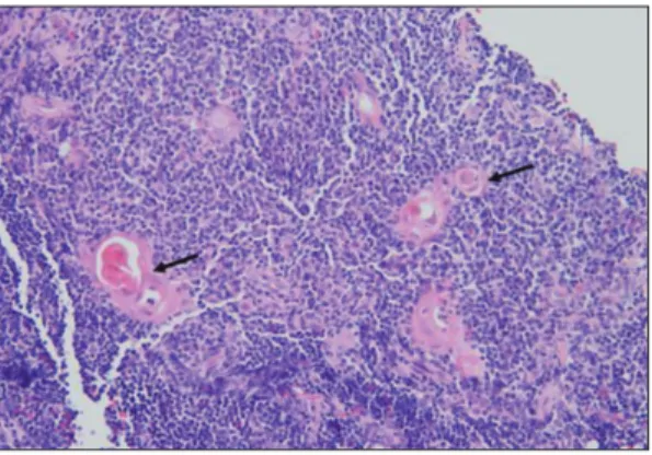 Fig. 3. Photomicrograph [hematoxylineosin (H-E) stain] 