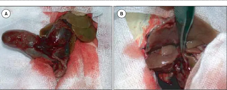 Fig.  2.  Microscopic  findings  of  the  extrahepatic  bile  duct  one  week  after  bile  duct  ligation