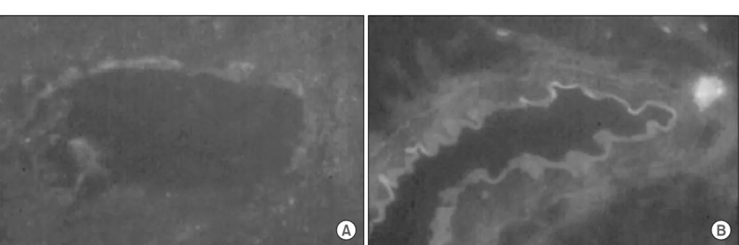 Fig.  4.  Diameter  of  bile  duct  treated  with  aminoguanidine  after  ligation.  Intraperitoneal  administration  of  aminoguanidine  inhibited  dilatation  of  bile  duct  after  the  bile  duct  ligation