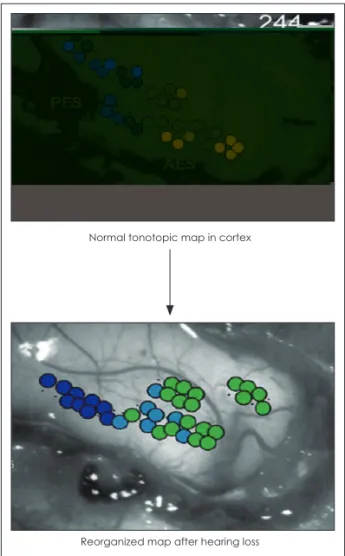 Fig. 6. Change of tonotopic map after hearing loss (Eg- (Eg-germont and Roberts, 2004).