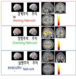 Fig. 1. MRI results for three attentional networks