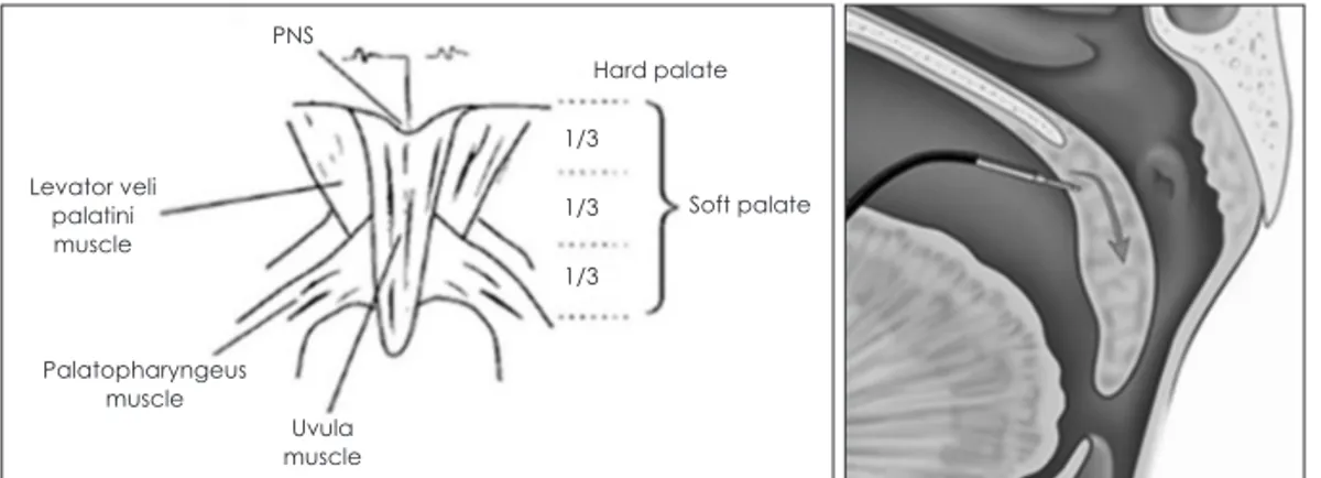 Fig. 14. Midline palate thirds. The muscular anatomy of the soft palate was viewed without the mucosa