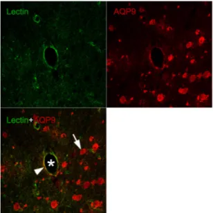 Fig.  10.  Representative  double-immunofluorescence  sections  of  AQP9  and  lectin  positive  cells  in  peri-hematoma  of  ICH-induced  rats