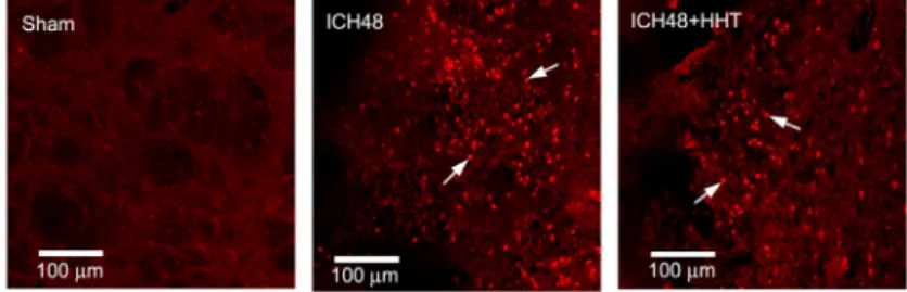 Fig.  4.  Representative  sections  of  MPO  positive  cells  in  peri-hematoma  of  ICH-induced  rats.