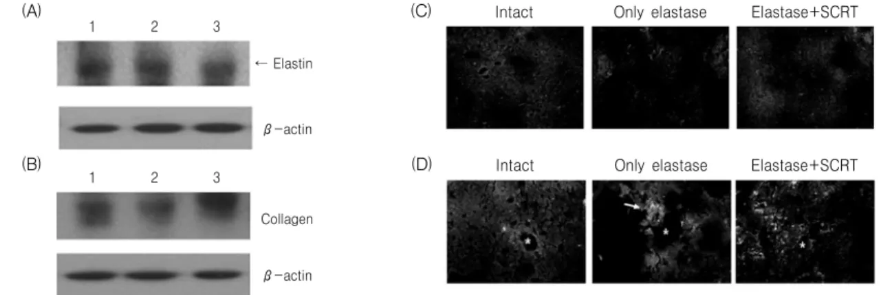Fig. 8. Protein  analysis  for  elastin  and  collagen  in  lung  tissue.  Mice  were  inhaled  with  elastase  once,  and  then  treated  with  SCRT  or  distilled  water  for  7  days
