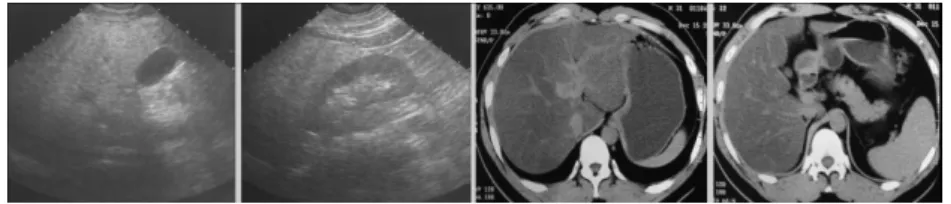 Fig. 1. Images  from  computed  topography  and  ultrasonography.