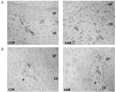 Fig. 4.  The  anti-inflammatory  effect  of  CR  in  burn  caused  skin.