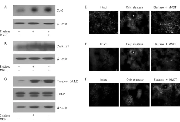 Fig. 9.  Cdc2,  cyclin  B1  and  phospho-Erk1  protein  analysis  in  lung  tissue.  Mice  were  inhaled  with  elastase  (0.4  unit)  once,  and  then  treated  with  MMDT  (400  ㎎/㎏,  p.o)  or  distilled  water  for  7  days