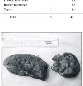 Fig.  8.  Bezoars  are  hard  consistency,  measuring  12  cm×6  cm×5  cm  and  7  cm×6  cm×4  cm  (Phytobezoar).Table  5