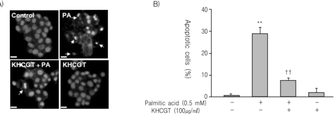 Fig. 3. The  protective  effect  of  KHchunggan-tang  (KHCGT)  against  palmitateinduced  apoptotic  cell  death  was  confirmed  again  by  DAPI  staining.