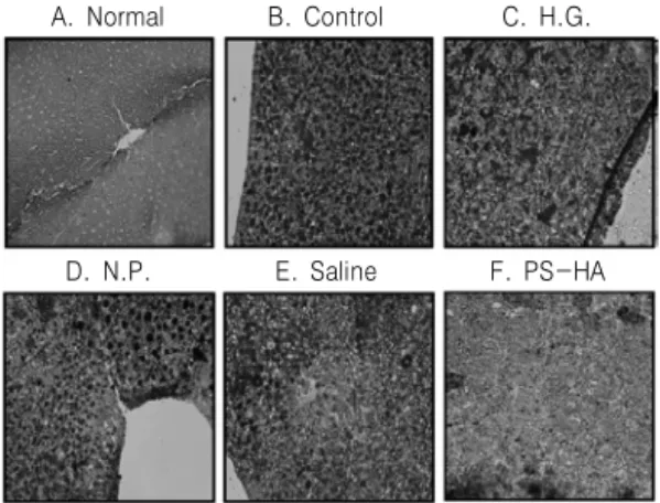 Fig. 8. Histological  analysis  of  liver  of  rats  with  hyperlipidemia(SBB  stain,  ×200).