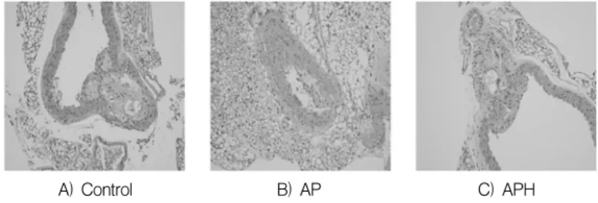 Fig. 1. Histological  Analysis  of  Aortic  Tissue  in  ApoE (-/-)   Mouse  Fed  with  Atherogenic  Diet(×200).