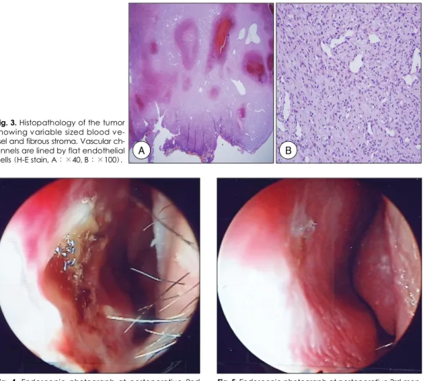 Fig. 2. Surgical specimen. 2×1.7×0.7 cm sized round mass has pinkish color and smooth surface