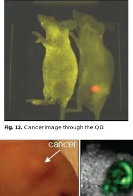 Fig. 12. Cancer image through the QD. 